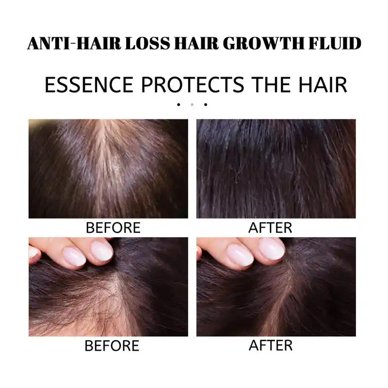 Rosemary Hair Care Essential Growth Oil Disposable Hair Care Solution
